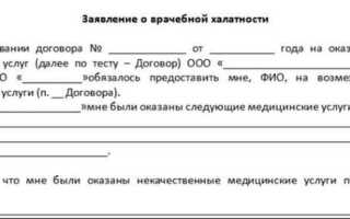 Халатность ст 293 ук рф за что можно привлечь
