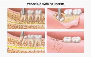 Удалили не тот зуб куда жаловаться