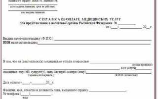 Форма нбо что за форма